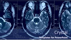  Presentation with brain mri - Colorful slide deck enhanced with brain-mri-slide backdrop and a ocean colored foreground