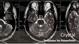  Presentation with mri brain - Beautiful PPT layouts featuring brain-mri-slide backdrop and a dark gray colored foreground