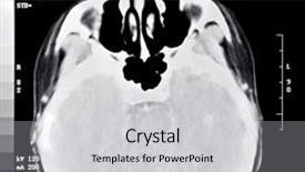  Presentation with brain structure - Audience pleasing presentation theme consisting of brain structure - ct scan segment backdrop and a light gray colored foreground