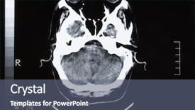  Presentation with brain injury - Presentation theme having brain tomography background and a ocean colored foreground