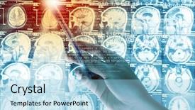  Presentation with human brain - Amazing presentation design having brain tumor - close up of human hand backdrop and a light blue colored foreground