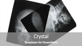  Presentation with piano black white - Amazing PPT theme having brain xray - black and white photo backdrop and a gray colored foreground