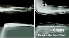  Presentation with radiation - Theme consisting of black body radiation - x-ray of both human arms background and a gray colored foreground