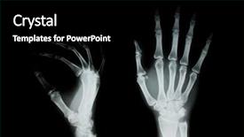  Presentation with human right - PPT theme enhanced with patients right - x-ray of human hand background and a black colored foreground