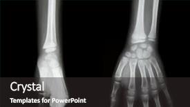  Presentation with human right - Presentation theme having patients right - x-ray of human hands background and a dark gray colored foreground
