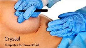  Presentation with breast surgery - Presentation design featuring breast surgery of body part background and a coral colored foreground