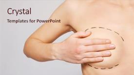  Presentation with honey bee closeup view - PPT layouts with closeup view of young woman with breasts marked for plastic operation on light background background and a lemonade colored foreground