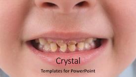  Presentation with teeth - Amazing theme having broken and rotten teeth backdrop and a coral colored foreground