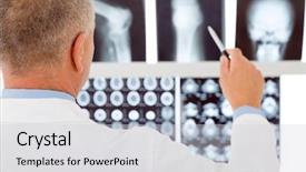  Presentation with professional - PPT theme with broken bones - professional male senior doctor pointing background and a light gray colored foreground