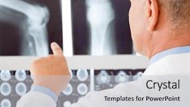  Presentation with professional - Beautiful slide deck featuring broken bones - professional male senior doctor pointing backdrop and a light gray colored foreground