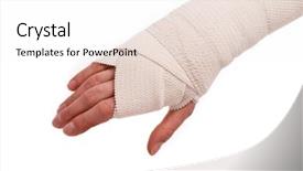  Presentation with injury - PPT layouts with broken bones - white medicine bandage on human background and a white colored foreground