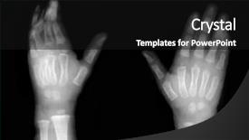  Presentation with film black and white - Slide deck enhanced with broken finger on black background and a black colored foreground