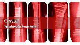  Presentation with broken leg - Slide deck with broken leg collection - x-ray background and a crimson colored foreground