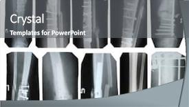  Presentation with broken leg - Colorful PPT theme enhanced with broken leg collection - x-ray backdrop and a gray colored foreground