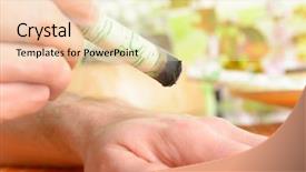  Presentation with burn - PPT theme consisting of burn patients - professional moxa stick in hands background and a soft green colored foreground