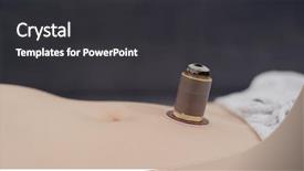  Presentation with traditional chinese medicine - Cool new PPT theme with burn patients - traditional chinese medicine moxibustion therapy backdrop and a dark gray colored foreground