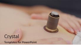  Presentation with traditional chinese medicine - Beautiful presentation featuring burn patients - traditional chinese medicine moxibustion therapy backdrop and a coral colored foreground