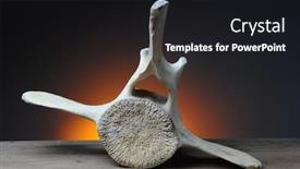  Presentation with wood gray - Beautiful slide set featuring cetacea - california gray whale vertebrae backdrop and a dark gray colored foreground