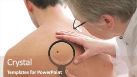  Presentation with nurse a male patient - Audience pleasing PPT theme consisting of cancer - dermatologist examines a mole backdrop and a coral colored foreground