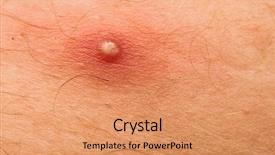  Presentation with extreme - Presentation consisting of carbuncle - pimple extreme macro background and a coral colored foreground