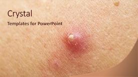  Presentation with human skin histology - Audience pleasing slide set consisting of listed unesco world heritage site - vairocana buddha leshan giant buddha backdrop and a gray colored foreground.