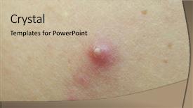  Presentation with extreme - Colorful slide set enhanced with carbuncle - pimple extreme on human skin backdrop and a soft green colored foreground