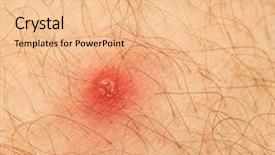  Presentation with human skin histology - Slide set having pair of british army desert background and a lemonade colored foreground.