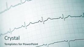  Presentation with cardiac arrest - Audience pleasing slides consisting of cardiac arrest - detail of an electrocardiogram backdrop and a sky blue colored foreground