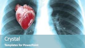  Presentation with human heart - Beautiful slide deck featuring cardiac scan - human x-ray with heart close-up backdrop and a teal colored foreground