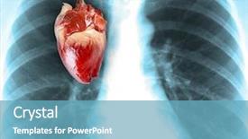  Presentation with human heart - Presentation design with cardiac scan - human x-ray with heart close-up background and a teal colored foreground