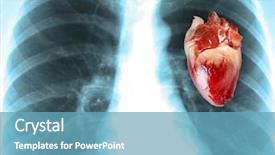  Presentation with human heart - Colorful slide set enhanced with cardiac scan - human x-ray with heart close-up backdrop and a teal colored foreground