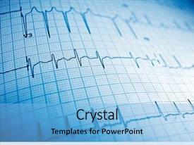 Presentation with cardiology - Audience pleasing theme consisting of cardiology - close up of an electrocardiogram backdrop and a light blue colored foreground