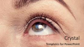 Presentation with eye cataract - Cool new theme with concept senior woman's eye backdrop and a coral colored foreground