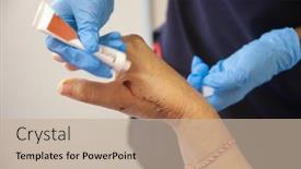  Presentation with wounds - Colorful slide set enhanced with caucasian-woman-with-broken-hands backdrop and a mint green colored foreground