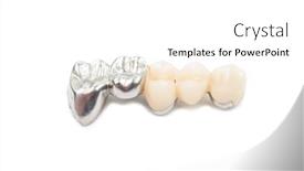  Presentation with ceramic - Audience pleasing presentation theme consisting of ceramic tooth crowns and metal pins close-up on white backdrop and a white colored foreground