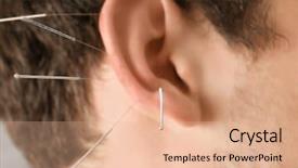  Presentation with acupuncture - Amazing slide set having smoking cessation - man's ear with needles closeup backdrop and a lemonade colored foreground