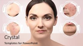  Presentation with acne woman - PPT layouts having change medicine - woman face background and a coral colored foreground