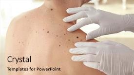  Presentation with clinic - Presentation theme consisting of check mark - dermatologist examining patient in clinic background and a lemonade colored foreground