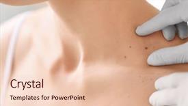  Presentation with chemotherapy - PPT theme consisting of chemotherapy - dermatologist examining birthmark of patient background and a lemonade colored foreground