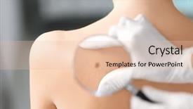  Presentation with chemotherapy - PPT theme featuring chemotherapy - dermatologist examining birthmark of patient background and a lemonade colored foreground