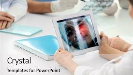  Presentation with lung - Audience pleasing slides consisting of chest on screen lung cancer backdrop and a white colored foreground