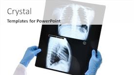  Presentation with chest - Beautiful presentation theme featuring chest-x-ray-emerges backdrop and a white colored foreground