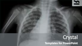  Presentation with chest - Slide set consisting of chest x-ray of young background and a gray colored foreground