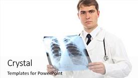  Presentation with xray - Colorful PPT layouts enhanced with chest xray - medical theme serious doctor holding backdrop and a white colored foreground