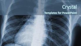  Presentation with xray - Colorful PPT theme enhanced with chest xray scan backdrop and a ocean colored foreground