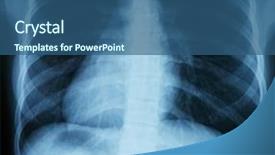  Presentation with xray - PPT theme having chest xray scan background and a ocean colored foreground