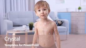  Presentation with cute - Beautiful slides featuring viral infection - cute little boy with chickenpox backdrop and a light blue colored foreground