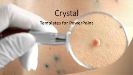  Presentation with skin - Slides enhanced with papilloma - dermatologist looking at skin background and a lemonade colored foreground