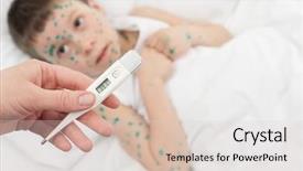  Presentation with measurement - PPT layouts having chickenpox - temperature measurement sick boy background and a  colored foreground