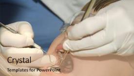  Presentation with dental pediatric - Audience pleasing PPT theme consisting of child getting a dental backdrop and a  colored foreground